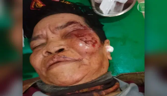 Pelaku Tahari, Ayah yang Memperkosa Anak Kandung Tuna Wicara di Gowa Babak Belur Usai Dihajar Warga Kasus Pemerkosaan Anak di Gowa, Rumah Pelaku Porak-poranda, Polisi Bertindak