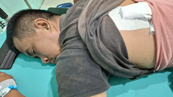 Kondisi Rahmat Saputra (36), pedagang korban pembacokan di Percut Sei Tuan, saat menjalani perawatan medis. Tampak perban menutup luka jahitan di bagian punggungnya. Pembacok Pedagang Percut Sei Tuan Ingkar Janji, Polisi Didesak Bertindak